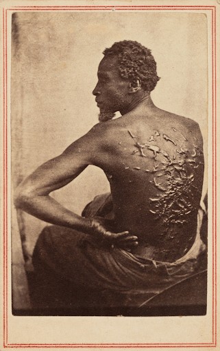 Photo of slavery